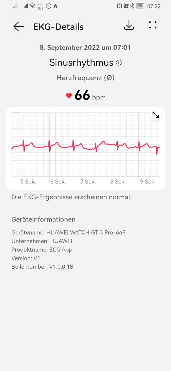 HUAWEI Watch GT 3 Pro Firmware Übersicht 11 HUAWEI Watch GT 3 Pro Firmware Übersicht 2